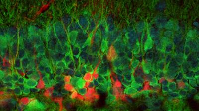 This Is The First Ever Image Of New Neurons Forming In A Live Brain