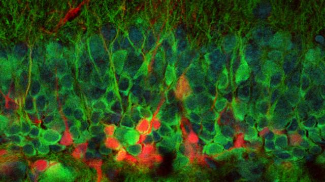 This Is The First Ever Image Of New Neurons Forming In A Live Brain
