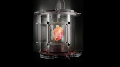 This Heart In A Jar Could Make Heart Transplants Safer