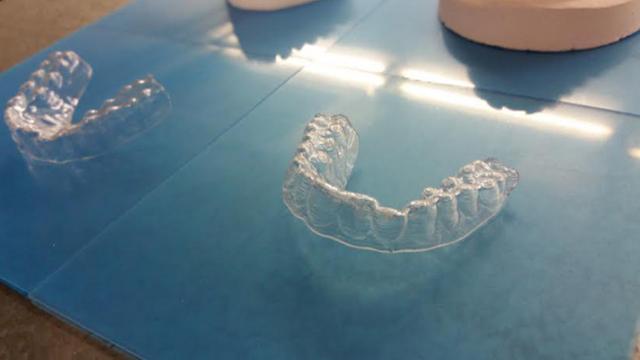 3D Printing Your Own Braces Works And Is A Terrible Idea