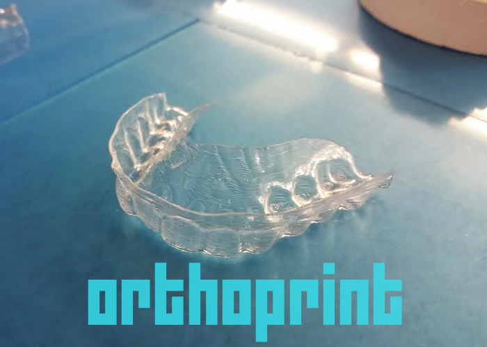 3D Printing Your Own Braces Works And Is A Terrible Idea