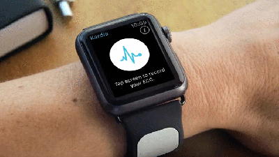 A Clever New Strap Brings EKG Readings To The Apple Watch