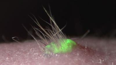 Super Realistic Lab-Grown Skin Even Sprouts Hair