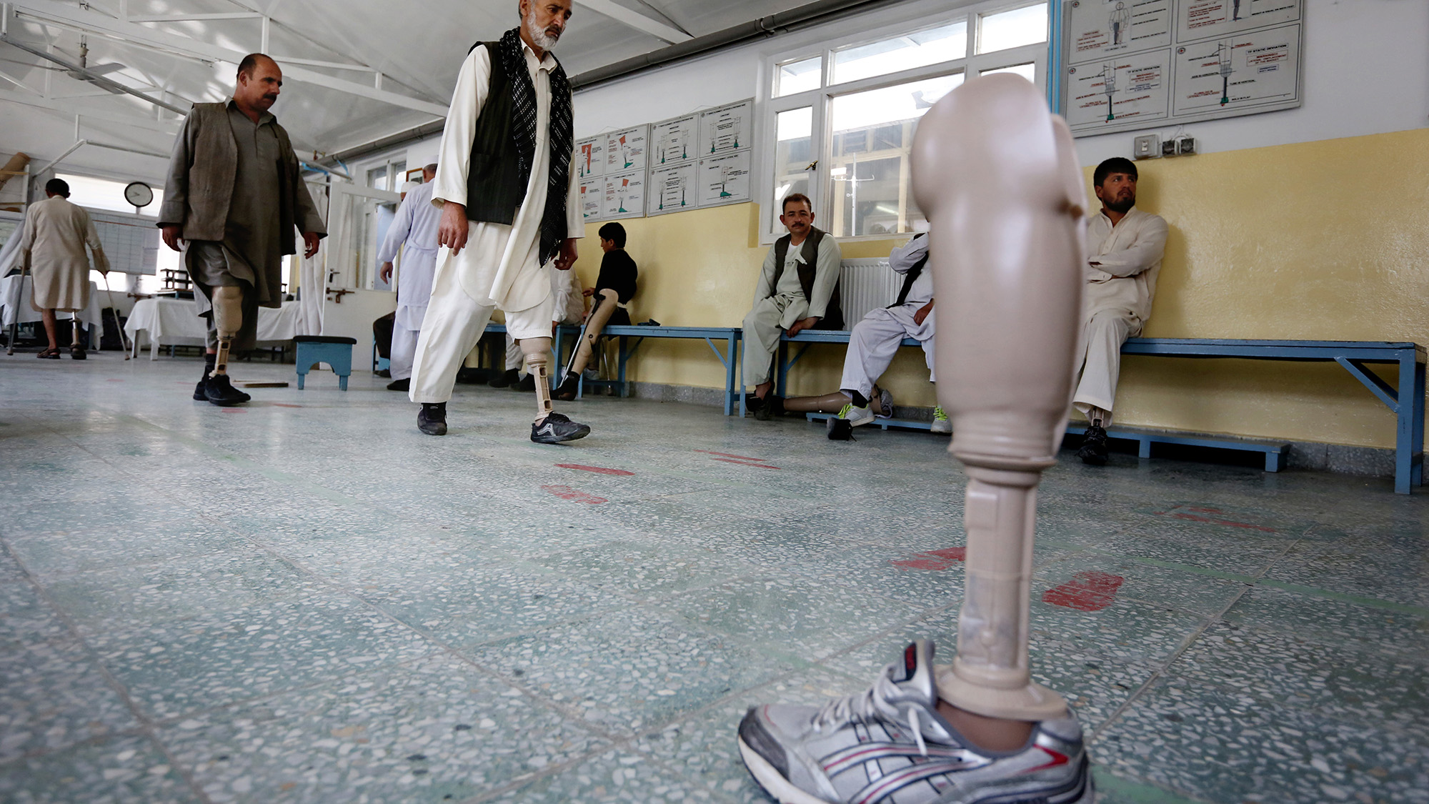 Inside Afghanistan’s Prosthetics Centre