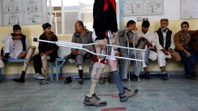 Inside Afghanistan’s Prosthetics Centre