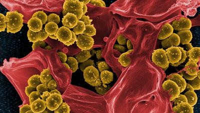 Antibiotic-Resistant Superbugs Could Kill 10 Million People A Year By 2050