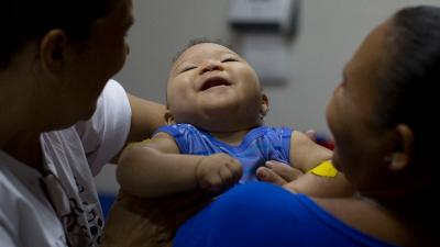 Zika Can Cause Birth Defects Even If Mothers Show No Symptoms