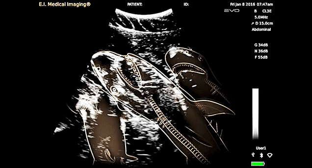 This Is What A Sonogram Of A Pregnant Shark Looks Like