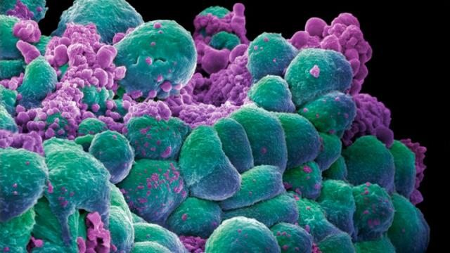 New Cancer Therapy Leaves Three Dead