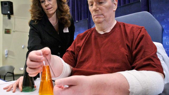 First American To Receive Double Hand Transplant Reveals It Was Unsuccessful