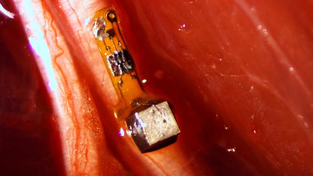 This Sensor Can Be Implanted In Your Body And Is The Size Of A Grain Of Sand