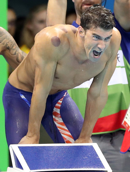 Those Weird Purple Circles On Michael Phelps Were From Cupping