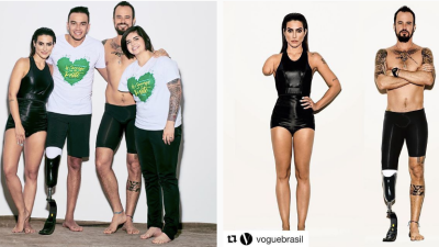Vogue Brazil Photoshopped Models To Look Like They Have Disabilities