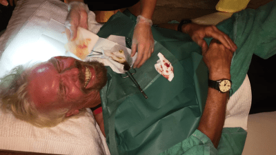 Richard Branson Got In Bloody Bike Crash, Lived To Blog About It
