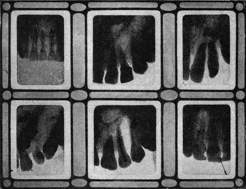 Going To The Dentist In 1909 Was A Nightmare, But X-Rays Were Supposed To Change All That