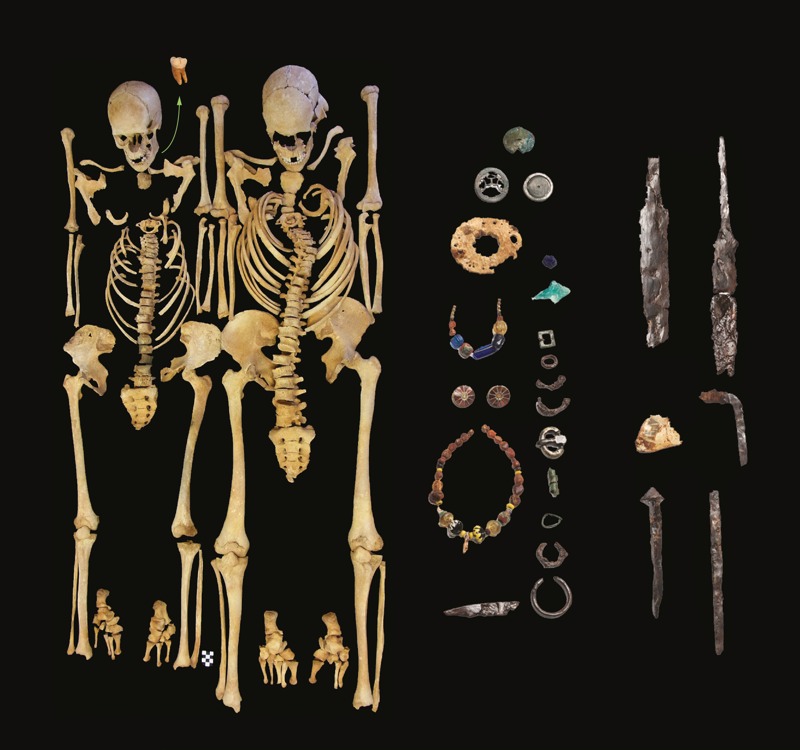 The Same Microbe That Led To Black Death Also Caused A Huge Plague Centuries Before 