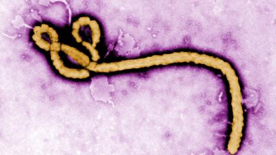 Clingy Ebola Virus Found Hanging Out In Man’s Semen For Over A Year