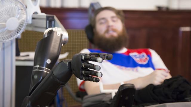 Brain Implant Allows Paralysed Man To Feel Objects With A Prosthetic Limb