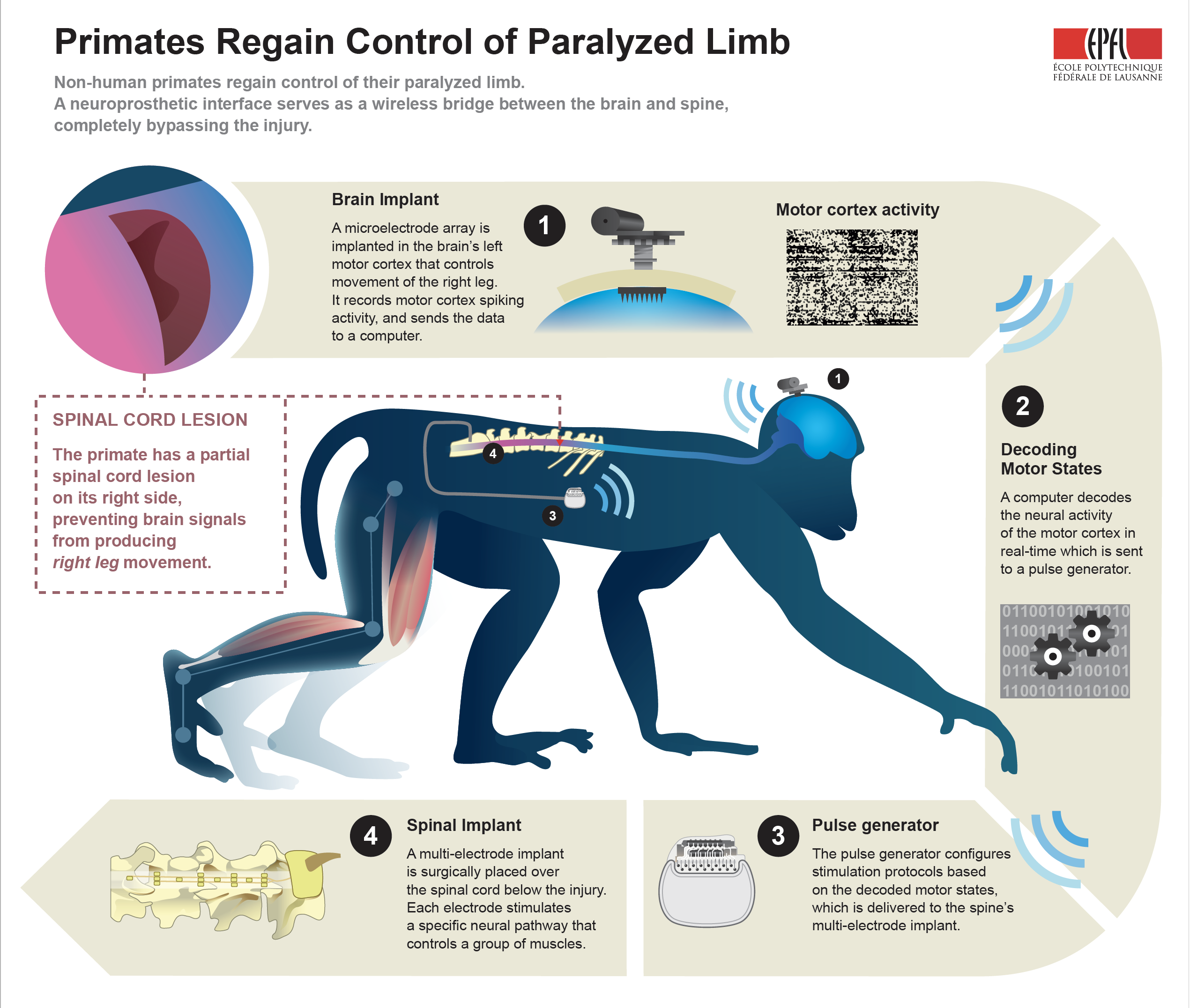 Brain Implant Allows Paralysed Monkey To Walk Again
