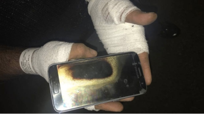 Man Says Galaxy S7 Exploded In His Hand: ‘I Should Have Lost My Eyes’