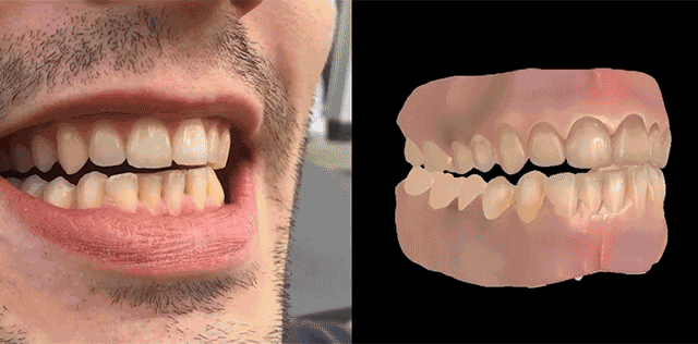 Researchers Can Create Perfect CG Dentures Using Just A Video Of Your Teeth