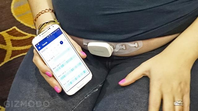 There Is Now A Wearable For Babies Before They Are Born