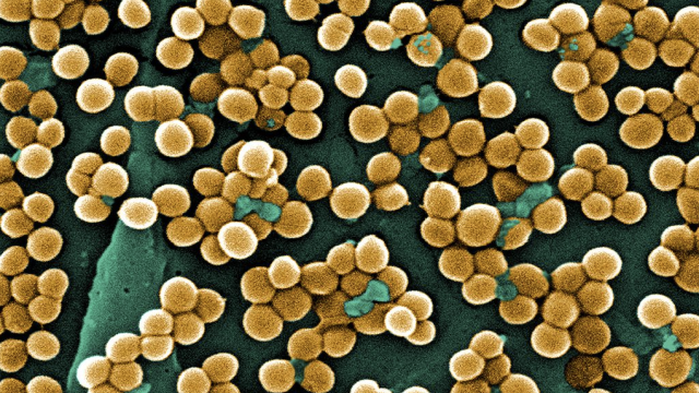 A Superbug Resistant To 26 Antibiotics Has Killed A Woman In Nevada