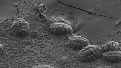 The Incredible Way Tardigrades Survive Total Dehydration