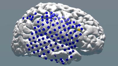 New Research Shows Electric Brain Stimulation Can Help Memory