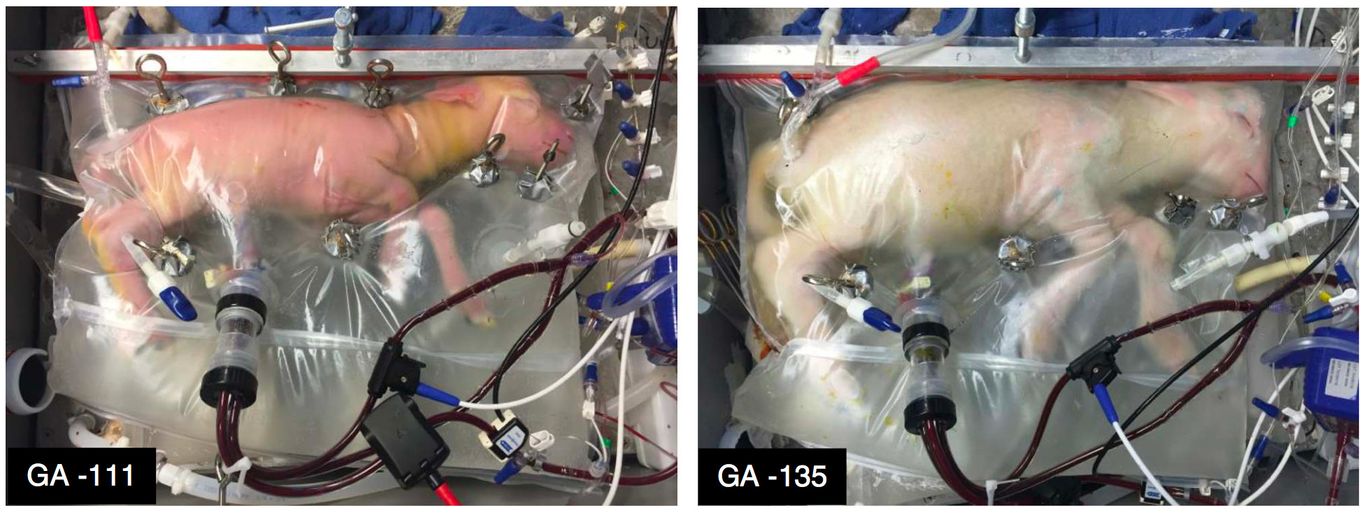 This Artificial Womb Could Revolutionise The Way We Treat Premature Babies 