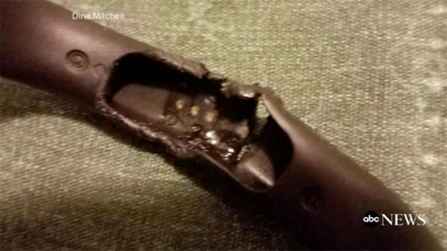 Fitbit Explodes On Woman’s Wrist, Because Catastrophic Failure Is Always An Option