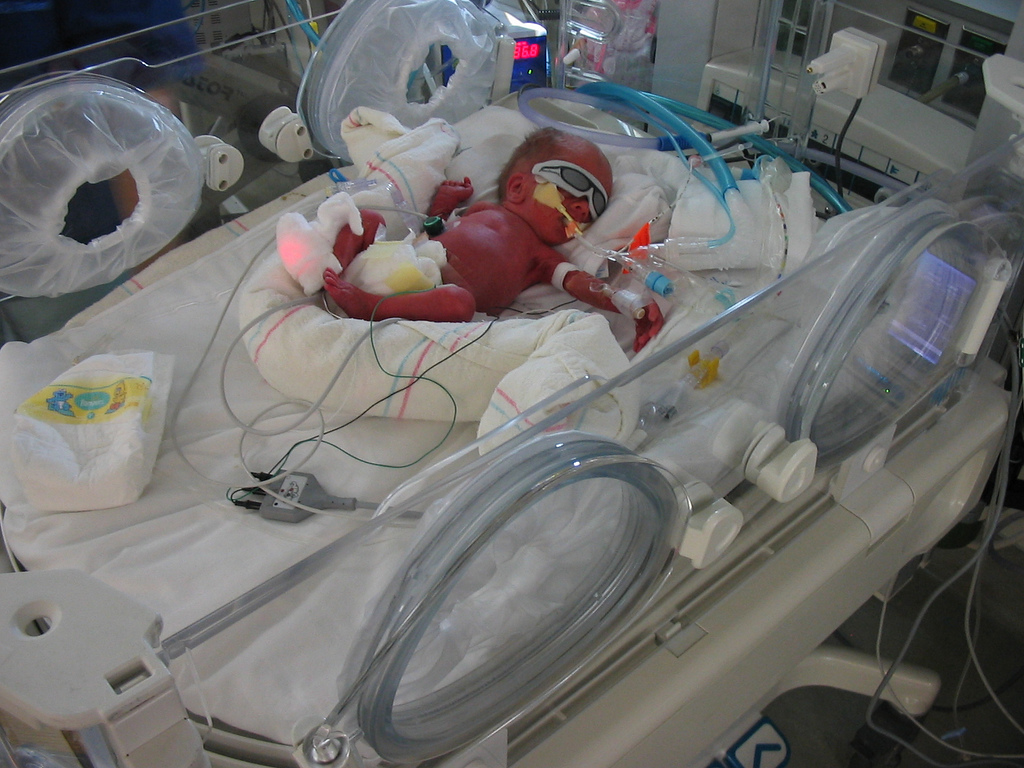 This Artificial Womb Could Revolutionise The Way We Treat Premature Babies 