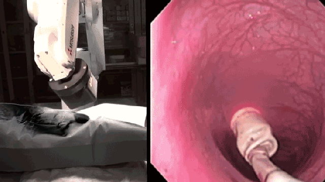 Doctors Have Built A Magnetic Robot To Gently Explore Your Colon