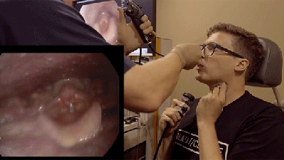 The Inside Of A Beatboxer’s Throat Is A Disgusting Display Of Anatomical Gymnastics