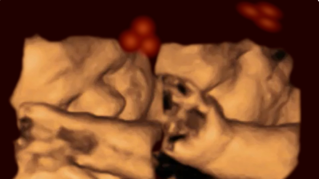 Can Fetuses Recognise Faces When They’re Still In The Womb?