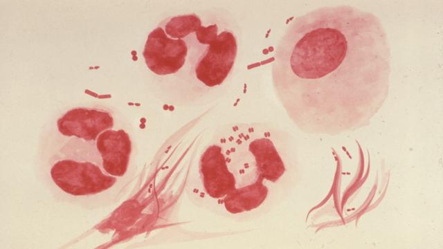 The First Gonorrhoea Vaccine May Be On The Horizon