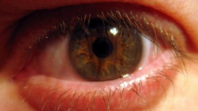 Your Eyeballs May Be Covered In Disease-Fighting Bacteria