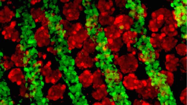 Lab-Grown Livers Might Save Lives Sooner Than You Think