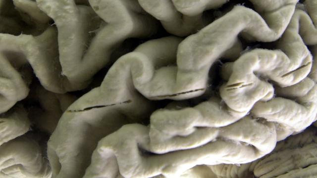A Third Of Dementia Cases Could Be Preventable, Says New Report