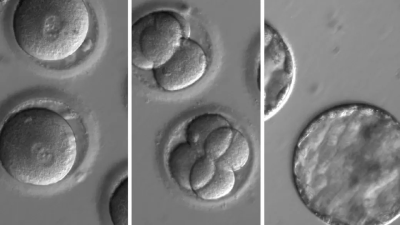 Experts Call On US To Start Funding Scientists To Genetically Engineer Human Embryos