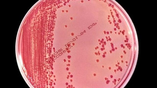 Scientist Sleuths Used DNA To Track Spread Of Superbug