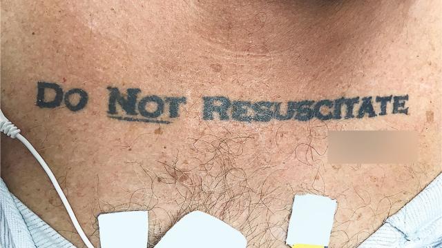 Unconscious Patient With ‘Do Not Resuscitate’ Tattoo Causes Ethical Conundrum At Hospital