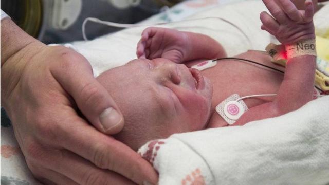 Woman Born Without Uterus Gives Birth In US Medical First
