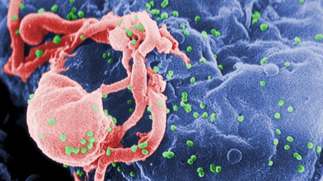 Why Has Science Only Cured One Person Of HIV?