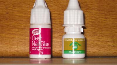 People Are ‘Frequently’ Mistaking  Superglue For Eye Drops And Oh No