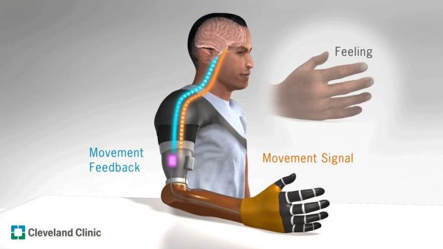 Scientists Create A Way For People With Amputations To Feel Their Prosthetic Hands