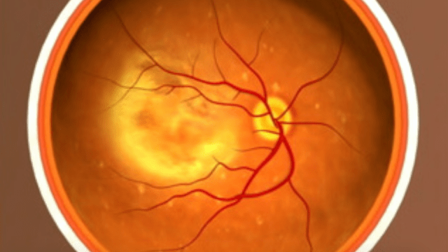 UK Doctors Used Stem Cells To Restore Eyesight In Two People