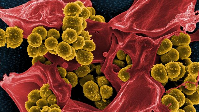 An Experimental Superbug Killer Is A Tiny Step Closer To Saving Us From The Antibiotic Apocalypse