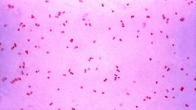 Super Gonorrhea Is Spreading, With Two New Cases Found In Australia