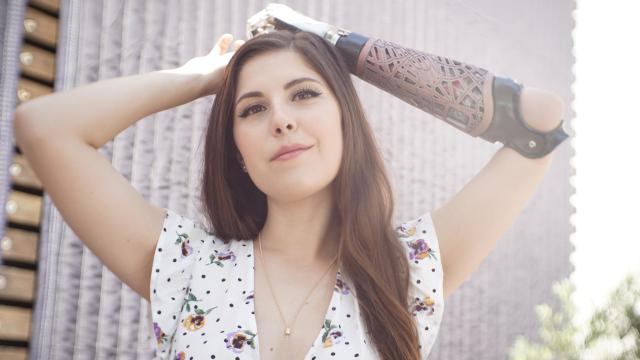 ‘Bionic Actress’ Angel Giuffria Is Ready For People With Disabilities To Get Their Close-Up